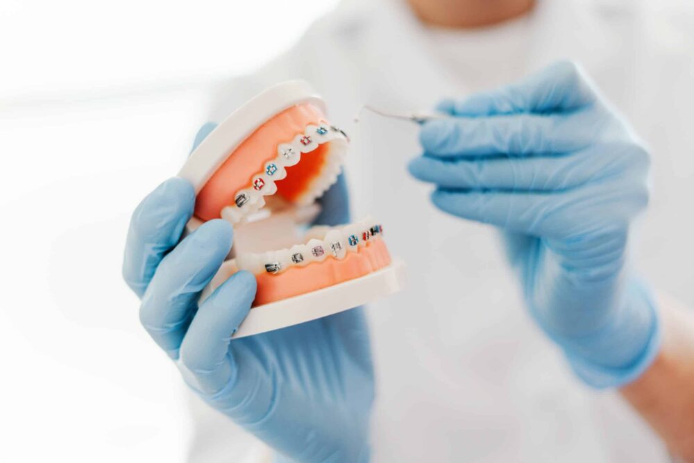 Orthodontics san francisco